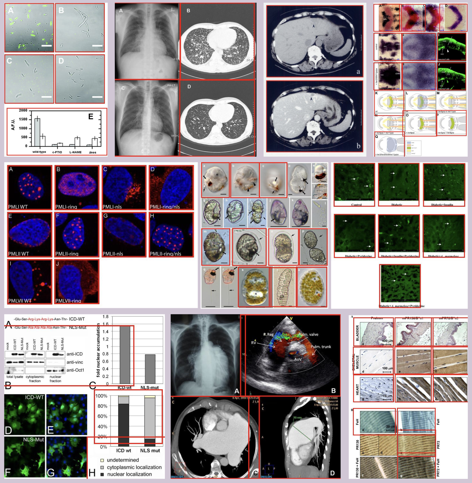 Qualitative subfigure detection: DAB-DETR localizes and separates panels in real PMC compound figures and ImageCLEF 2016 examples, each panel enclosed in a colored bounding box.